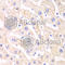 Proteasome Inhibitor Subunit 1 antibody, A5554, ABclonal Technology, Immunohistochemistry paraffin image 