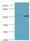 Cholinergic Receptor Nicotinic Alpha 5 Subunit antibody, LS-C375467, Lifespan Biosciences, Western Blot image 