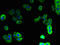 Progestin And AdipoQ Receptor Family Member 5 antibody, LS-C398018, Lifespan Biosciences, Immunofluorescence image 