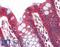 Perilipin 1 antibody, LS-B3034, Lifespan Biosciences, Immunohistochemistry paraffin image 