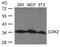 Cyclin Dependent Kinase 2 antibody, 79-547, ProSci, Western Blot image 