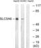 Solute Carrier Family 5 Member 6 antibody, LS-C120411, Lifespan Biosciences, Western Blot image 