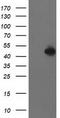 PBX Homeobox 1 antibody, TA503230S, Origene, Western Blot image 