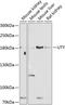 Ubiquitously Transcribed Tetratricopeptide Repeat Containing, Y-Linked antibody, A07639, Boster Biological Technology, Western Blot image 