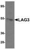 Lymphocyte Activating 3 antibody, A02869, Boster Biological Technology, Western Blot image 