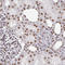 Adenosine Deaminase RNA Specific antibody, AMAb90535, Atlas Antibodies, Immunohistochemistry frozen image 