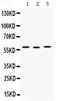 Cyclase Associated Actin Cytoskeleton Regulatory Protein 1 antibody, PB9923, Boster Biological Technology, Western Blot image 