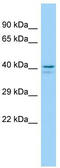 G Protein-Coupled Receptor 45 antibody, TA332010, Origene, Western Blot image 