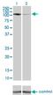 Protein Kinase N1 antibody, MA5-19703, Invitrogen Antibodies, Western Blot image 