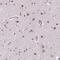 Period Circadian Regulator 2 antibody, NBP2-49316, Novus Biologicals, Immunohistochemistry frozen image 