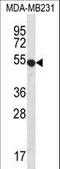 Probable G-protein coupled receptor 34 antibody, LS-B9177, Lifespan Biosciences, Western Blot image 