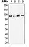 Lysine Acetyltransferase 2B antibody, orb214839, Biorbyt, Western Blot image 