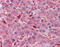 Activated Leukocyte Cell Adhesion Molecule antibody, 51-304, ProSci, Immunohistochemistry paraffin image 