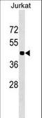 Homeobox C10 antibody, LS-C159865, Lifespan Biosciences, Western Blot image 