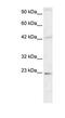 High Mobility Group Box 2 antibody, PA1-24399, Invitrogen Antibodies, Western Blot image 