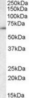 T-complex protein 1 subunit gamma antibody, NBP1-51949, Novus Biologicals, Western Blot image 