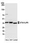 Vesicle Trafficking 1 antibody, A304-829A, Bethyl Labs, Western Blot image 