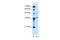Armadillo Repeat Containing X-Linked 6 antibody, 31-340, ProSci, Western Blot image 