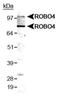 Roundabout Guidance Receptor 4 antibody, NB110-58778, Novus Biologicals, Western Blot image 