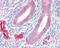 ADAM Metallopeptidase Domain 33 antibody, PA5-28128, Invitrogen Antibodies, Immunohistochemistry paraffin image 