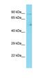 VPS50 Subunit Of EARP/GARPII Complex antibody, orb326789, Biorbyt, Western Blot image 