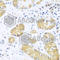 Ubiquitin C-Terminal Hydrolase L3 antibody, A8156, ABclonal Technology, Immunohistochemistry paraffin image 
