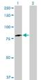 DEAD-Box Helicase 3 Y-Linked antibody, H00008653-D01P, Novus Biologicals, Western Blot image 