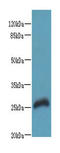 Receptor Transporter Protein 2 antibody, A65270-100, Epigentek, Western Blot image 