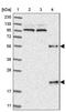 Mannan Binding Lectin Serine Peptidase 2 antibody, PA5-56112, Invitrogen Antibodies, Western Blot image 