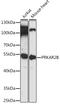Protein Kinase CAMP-Dependent Type II Regulatory Subunit Beta antibody, LS-C747831, Lifespan Biosciences, Western Blot image 