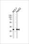 Proteasome activator complex subunit 2 antibody, MBS9214742, MyBioSource, Western Blot image 