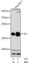 Interleukin 2 antibody, 16-547, ProSci, Western Blot image 