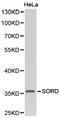 Sorbitol Dehydrogenase antibody, LS-C192904, Lifespan Biosciences, Western Blot image 