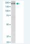 Kinesin Family Member 13B antibody, H00023303-M01-100ug, Novus Biologicals, Western Blot image 