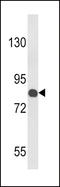 Cartilage Oligomeric Matrix Protein antibody, LS-C166937, Lifespan Biosciences, Western Blot image 