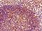 HLA class II histocompatibility antigen, DRB1-3 chain antibody, A52029-100, Epigentek, Immunohistochemistry paraffin image 