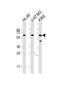 Interleukin 1 Receptor Like 2 antibody, PA5-71808, Invitrogen Antibodies, Western Blot image 