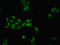 Dachshund Family Transcription Factor 1 antibody, LS-C677642, Lifespan Biosciences, Immunofluorescence image 