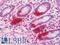 Phosphoglycerate kinase antibody, LS-C211232, Lifespan Biosciences, Immunohistochemistry paraffin image 