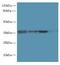 Programmed Cell Death 1 antibody, A60198-100, Epigentek, Western Blot image 