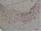 Calcium Voltage-Gated Channel Auxiliary Subunit Alpha2delta 1 antibody, STJ97510, St John