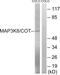 Mitogen-Activated Protein Kinase Kinase Kinase 8 antibody, abx012921, Abbexa, Western Blot image 