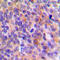 Toll Interacting Protein antibody, LS-C353474, Lifespan Biosciences, Immunohistochemistry paraffin image 