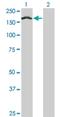 Treacher Collins syndrome protein antibody, H00006949-M02, Novus Biologicals, Western Blot image 