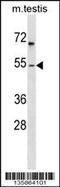 Forkhead box protein F1 antibody, 58-982, ProSci, Western Blot image 