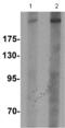 Chromodomain Helicase DNA Binding Protein 7 antibody, ab117522, Abcam, Western Blot image 