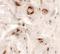 Uroplakin 1B antibody, LS-C144427, Lifespan Biosciences, Immunohistochemistry paraffin image 