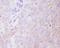 Hexokinase 1 antibody, M01504, Boster Biological Technology, Immunohistochemistry paraffin image 