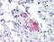 Stromal Interaction Molecule 1 antibody, orb89690, Biorbyt, Immunohistochemistry paraffin image 