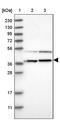 RNA methyltransferase-like protein 1 antibody, PA5-54671, Invitrogen Antibodies, Western Blot image 